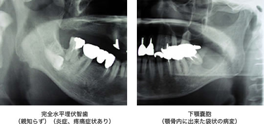 歯科 口腔外科 呉医療センター中国がんセンター 広島県呉市 病院