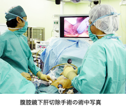 腹腔鏡下肝切除手術の術中写真