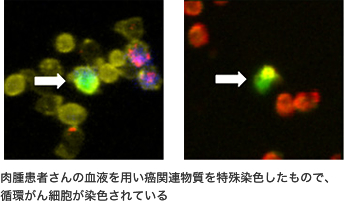写真　循環がん細胞が染色されている様子