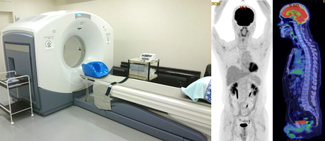 写真　PET-CT検査